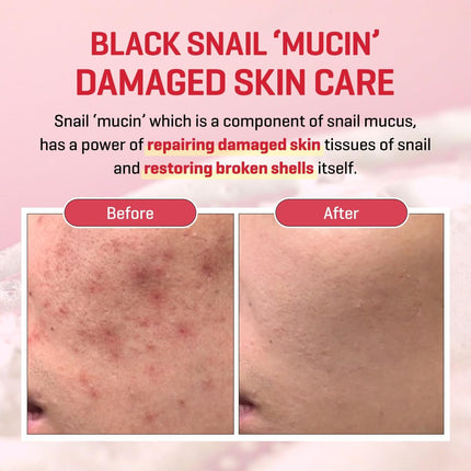 Some By Mi Snail Truecica Miracle Repair Cream | 60g | Made From Snail Mucin For Sensitive Skin | Daily Repair Face Moisturizer For Acne Marks & Strengthen Skin Barrier