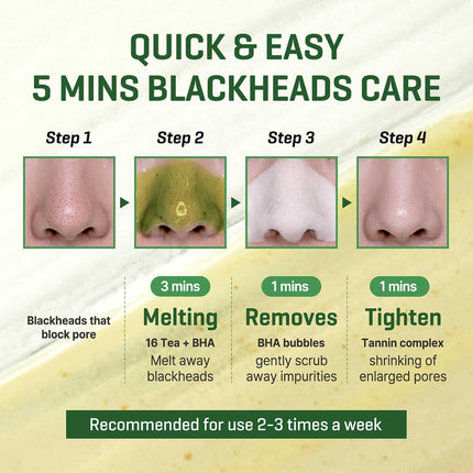 Some By Mi Bye Bye Blackhead 30 Days Miracle