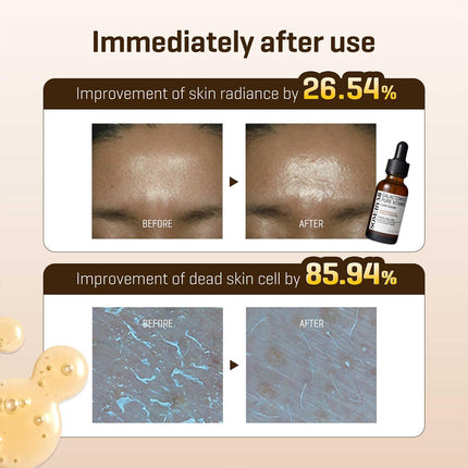 Some By Mi Galactomyces Pure Vitamin C Glow Serum | 30Ml | Daily Brightening Vitamin C Serum For Glass Skin | Improvement Of Skin Texture & Elasticity