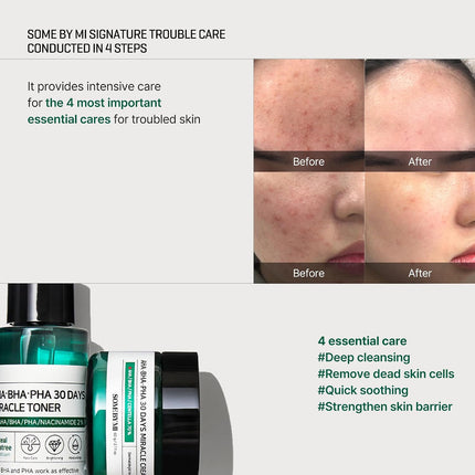 Some By Mi AHA-BHA-PHA 30 Days Miracle Starter Kit | Toner 30Ml + Serum 10Ml + Cream 20G + Cleansing Bar 30G | Set Of 4 Travel Kit